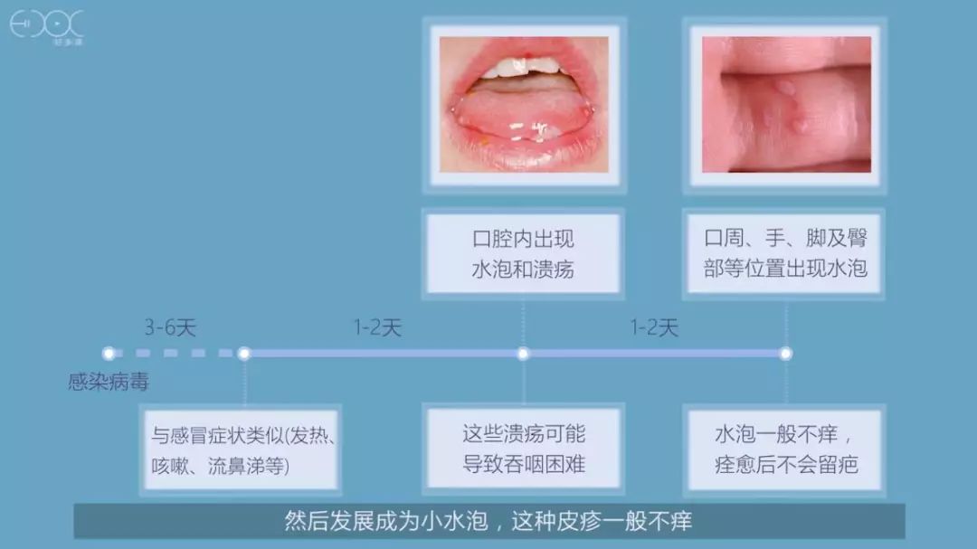 探索新生儿大便便秘的奥秘，家长必知的护理与预防策略