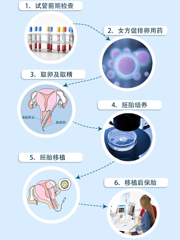 试管婴儿移植前的全面准备与注意事项