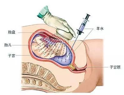 探索无痛人工流产的最佳时间，女性健康与权益的平衡